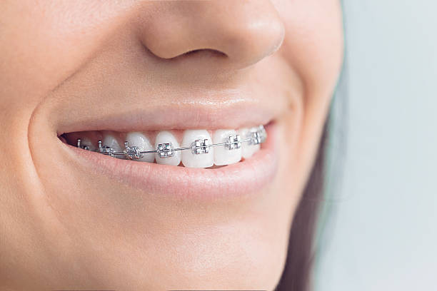 Full Mouth Reconstruction in Mount Ephraim, NJ